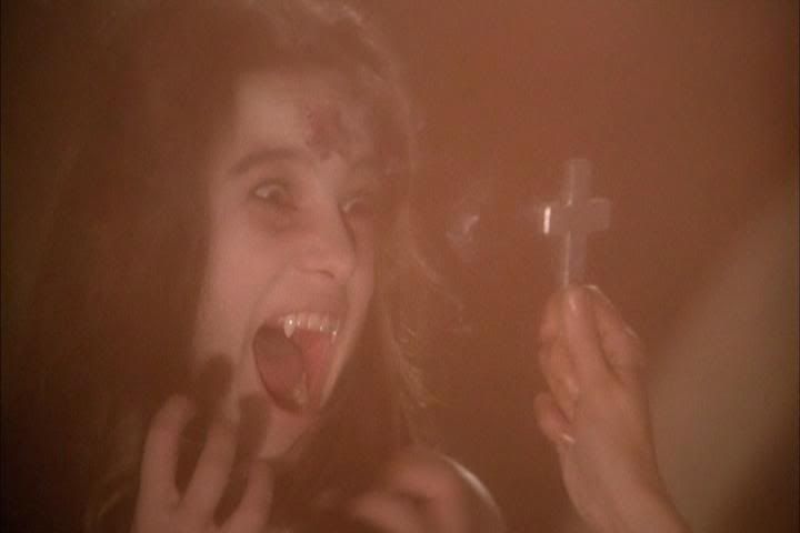 it burns